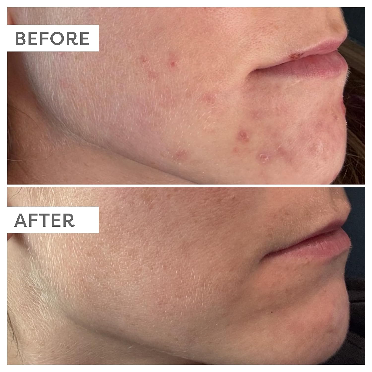 TruSkin Anti-Aging Serum – Vitamin C + Hyaluronic Acid for Radiant Skin - Image 3